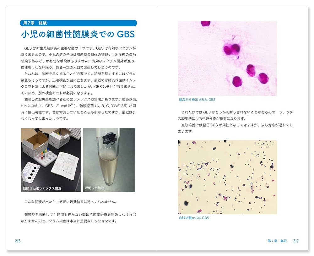 Amazon.co.jp: グラム染色道場2〈菌も病気も染め分けろ